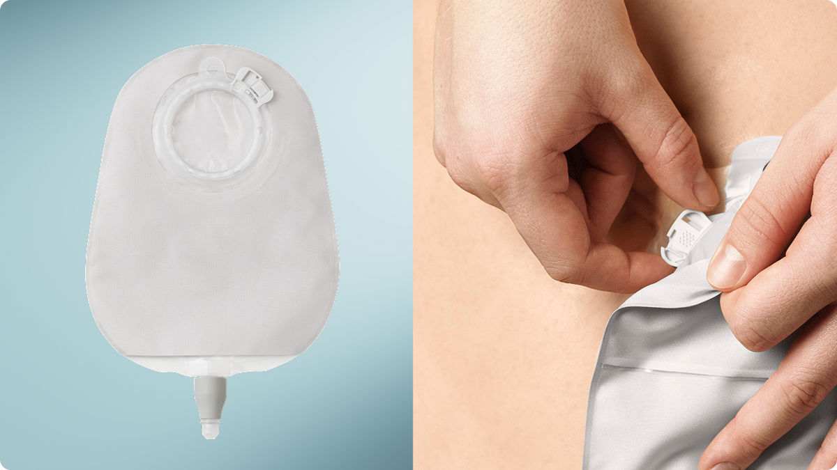 Zweiteiliges Bild mit SenSura Mio Urostomiebeutel links und Hand, die den Beutel mit Klick-Kopplung verschließt rechts