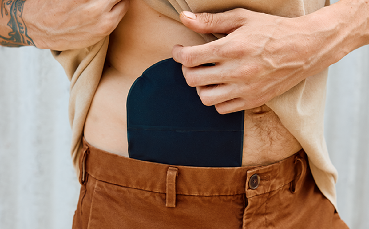 Mann mit schwarzem Stomabeutel von Coloplast am Bauch hebt sein beiges T-Shirt nach oben