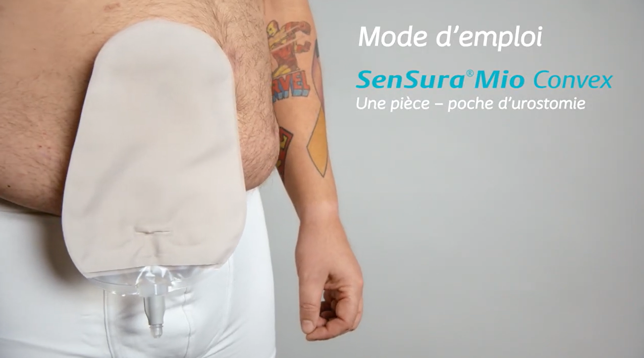 Utilisation de SenSura Mio Convex 1 pièce | Appareillage d'urostomie