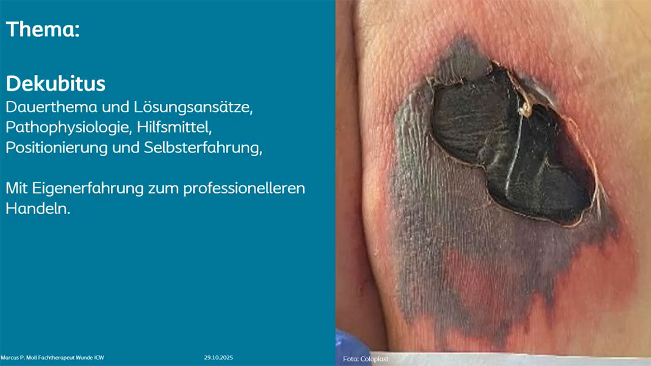 Teaser: Dekubitus muss nicht sein – Prävention und Behandlung
